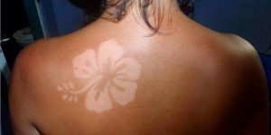 sunburn art