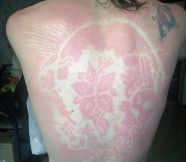 sunburn art2