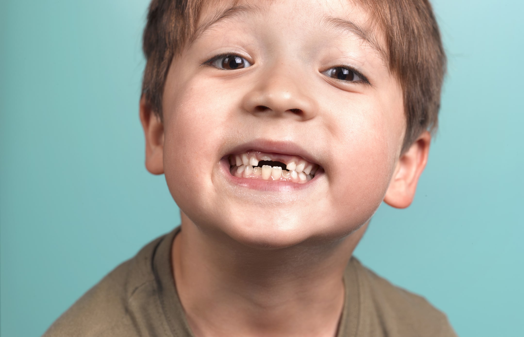 se queda sin dientes por una apuesta con su hermana