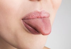 lengua mujer salud manchas