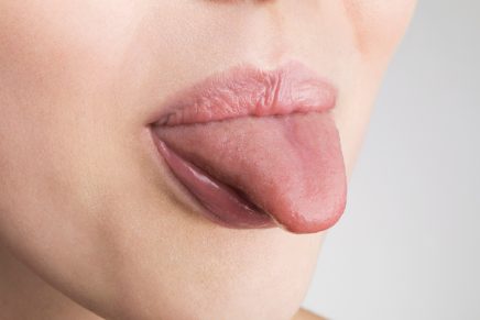 Qué dice mi lengua sobre mi estado de salud? Descubre todos los tipos y  apariencias - Cadena Dial