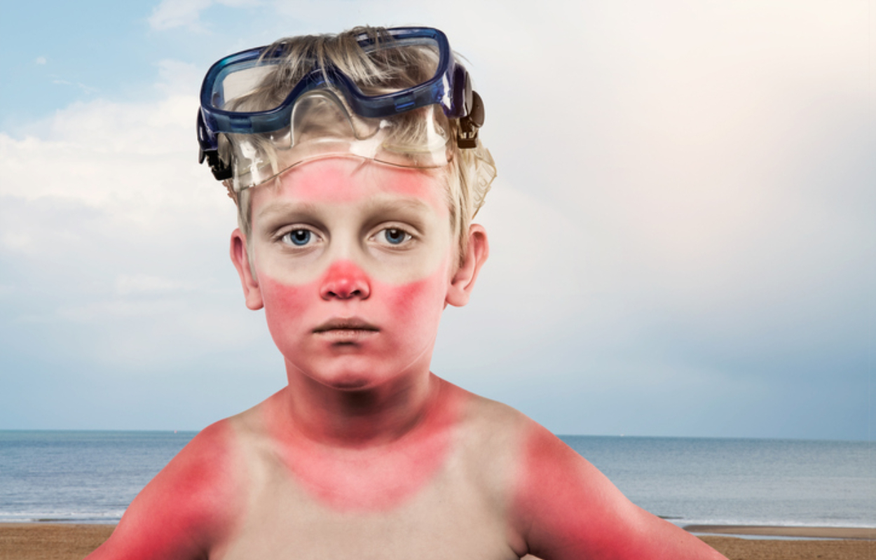 Sun Protection Tips for People with Blue Eyes and Pink Hair - wide 8