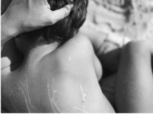 Cicatrices de Mael, el hijo de Raquel del Rosario