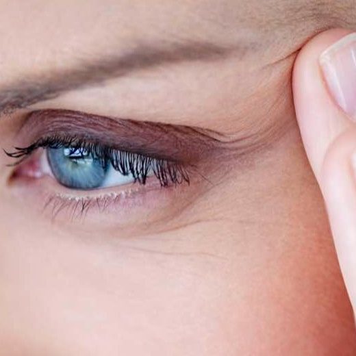 aparicion de arrugas