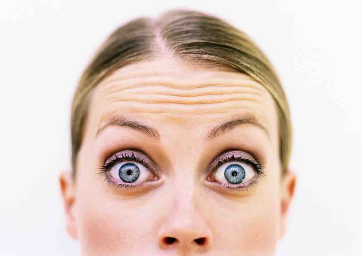 aparicion de arrugas