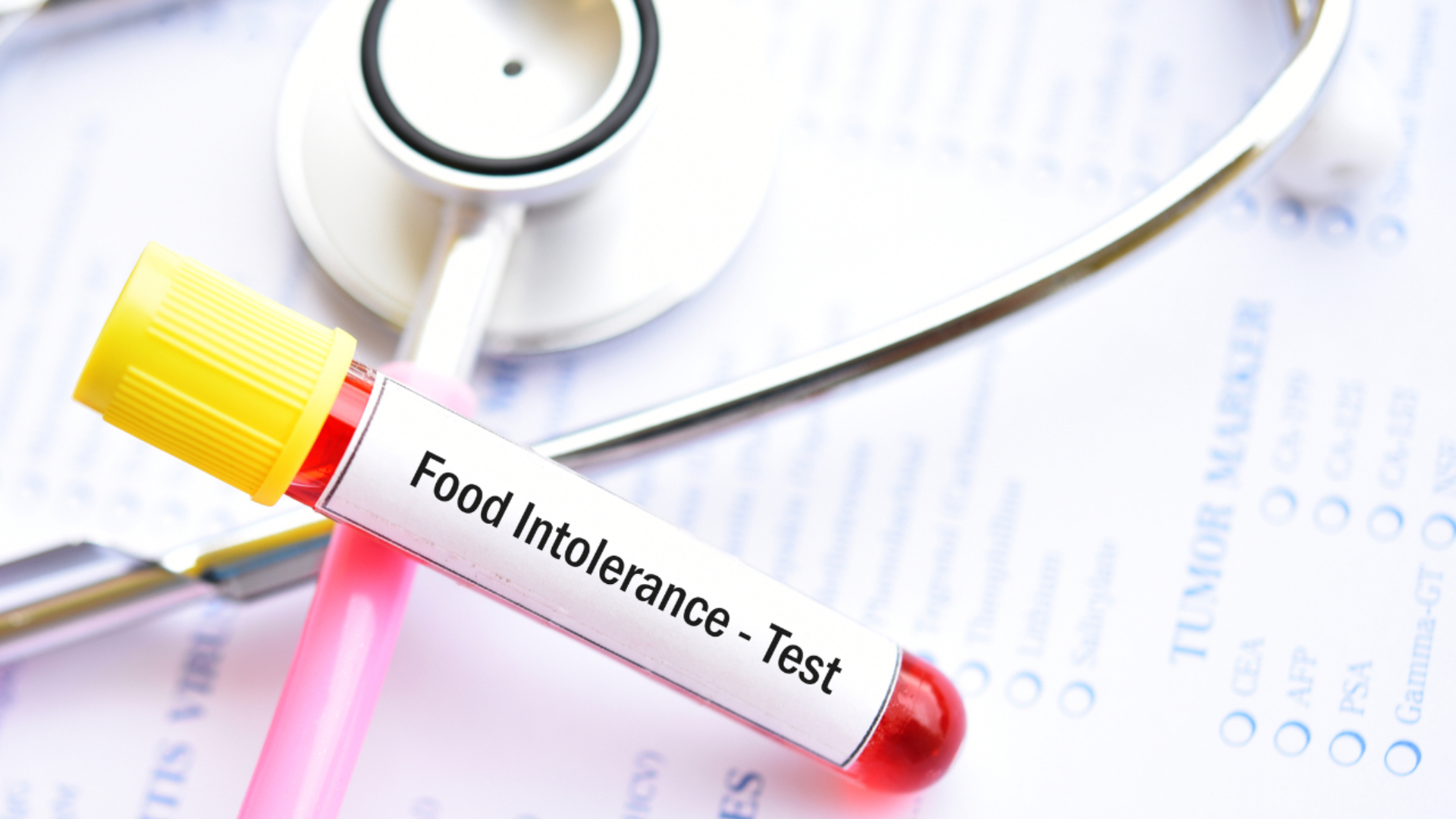 Test de intolerancia a los alimentos.