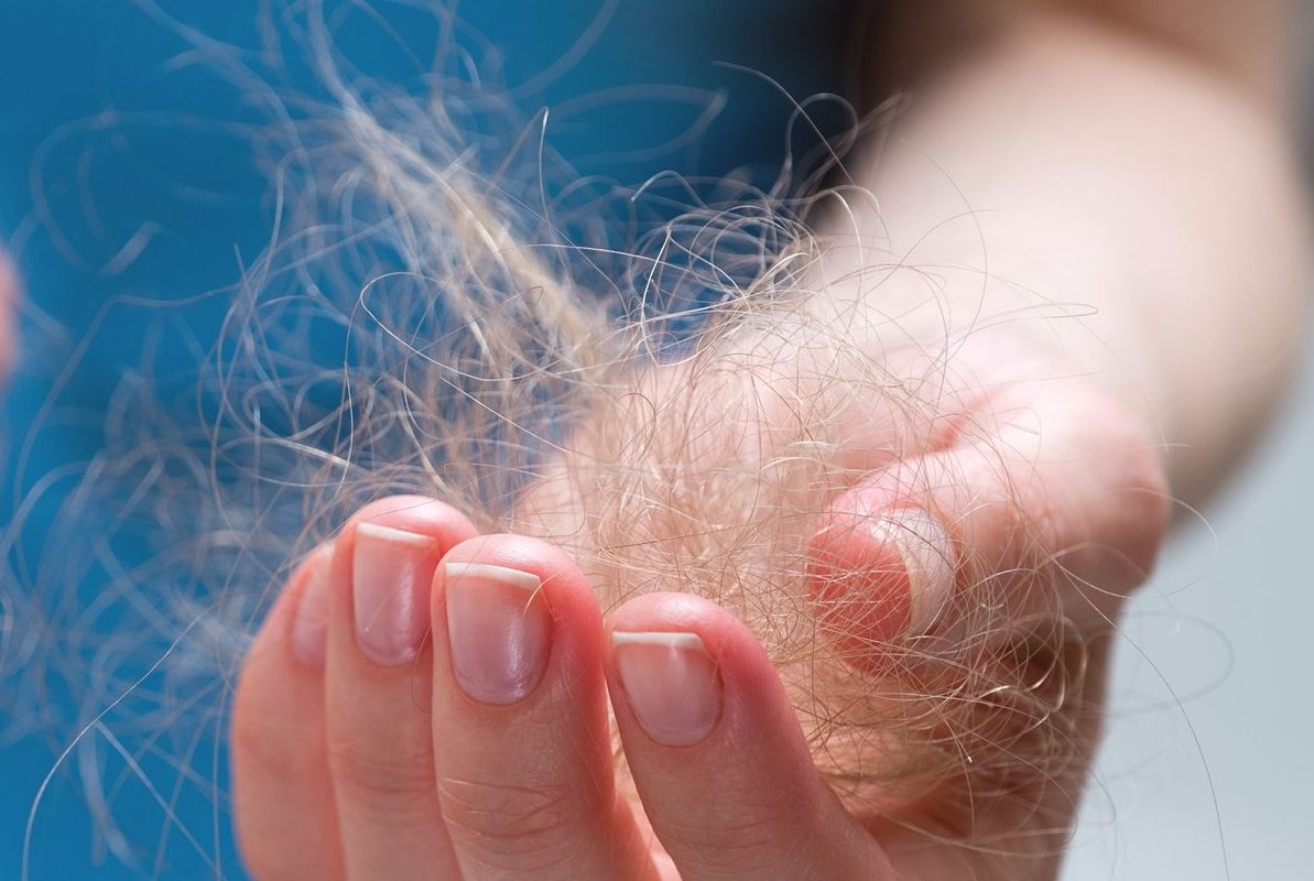 Cómo evitar la caída del pelo después del verano