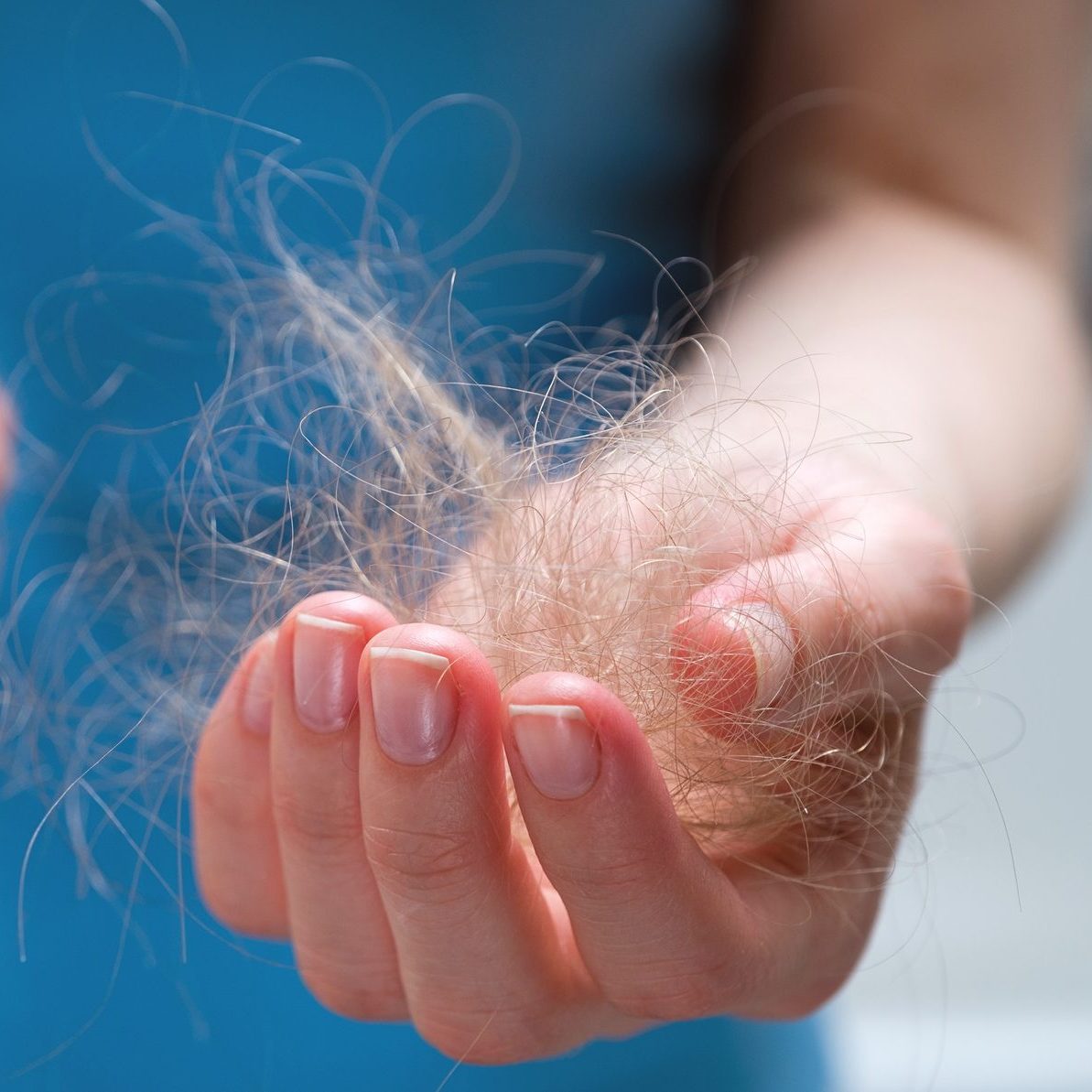 Cómo evitar la caída del pelo después del verano