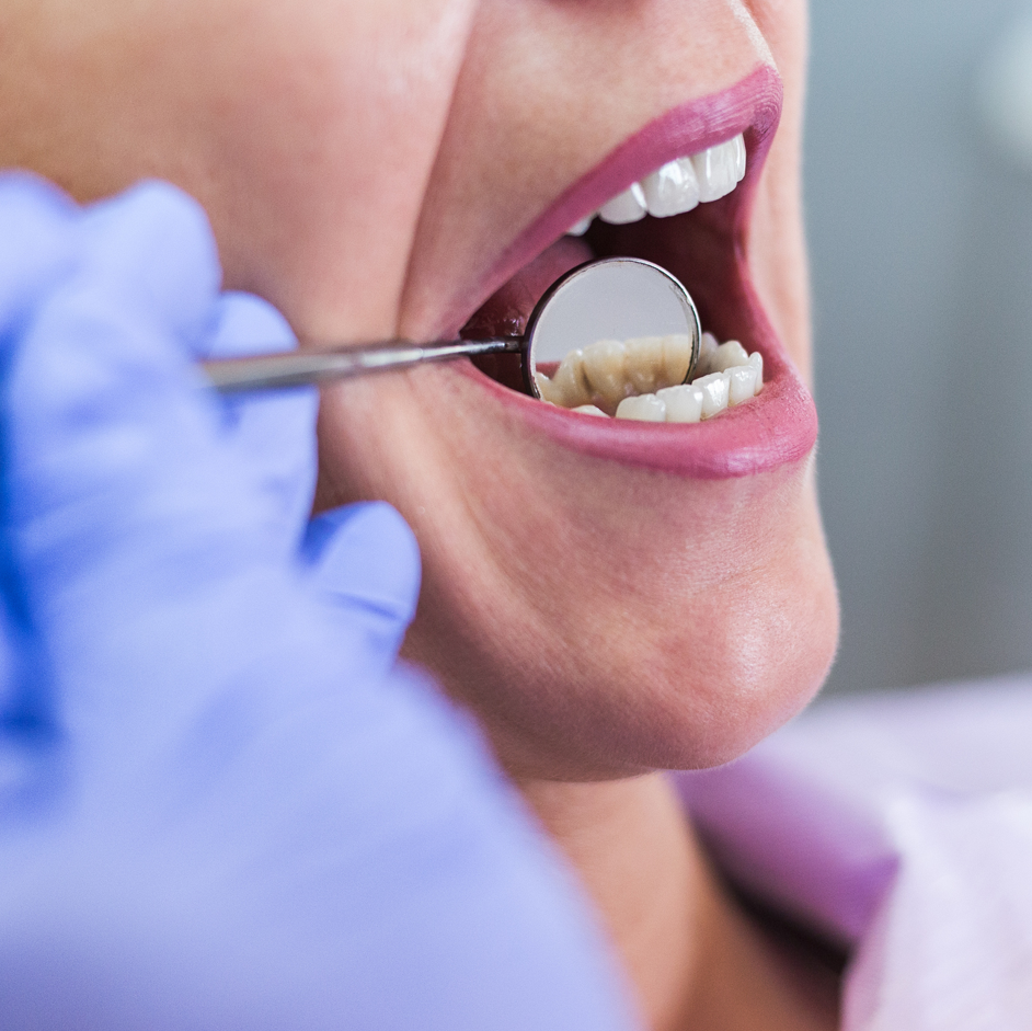 Un dentista revisa a una mujer si tiene caries.