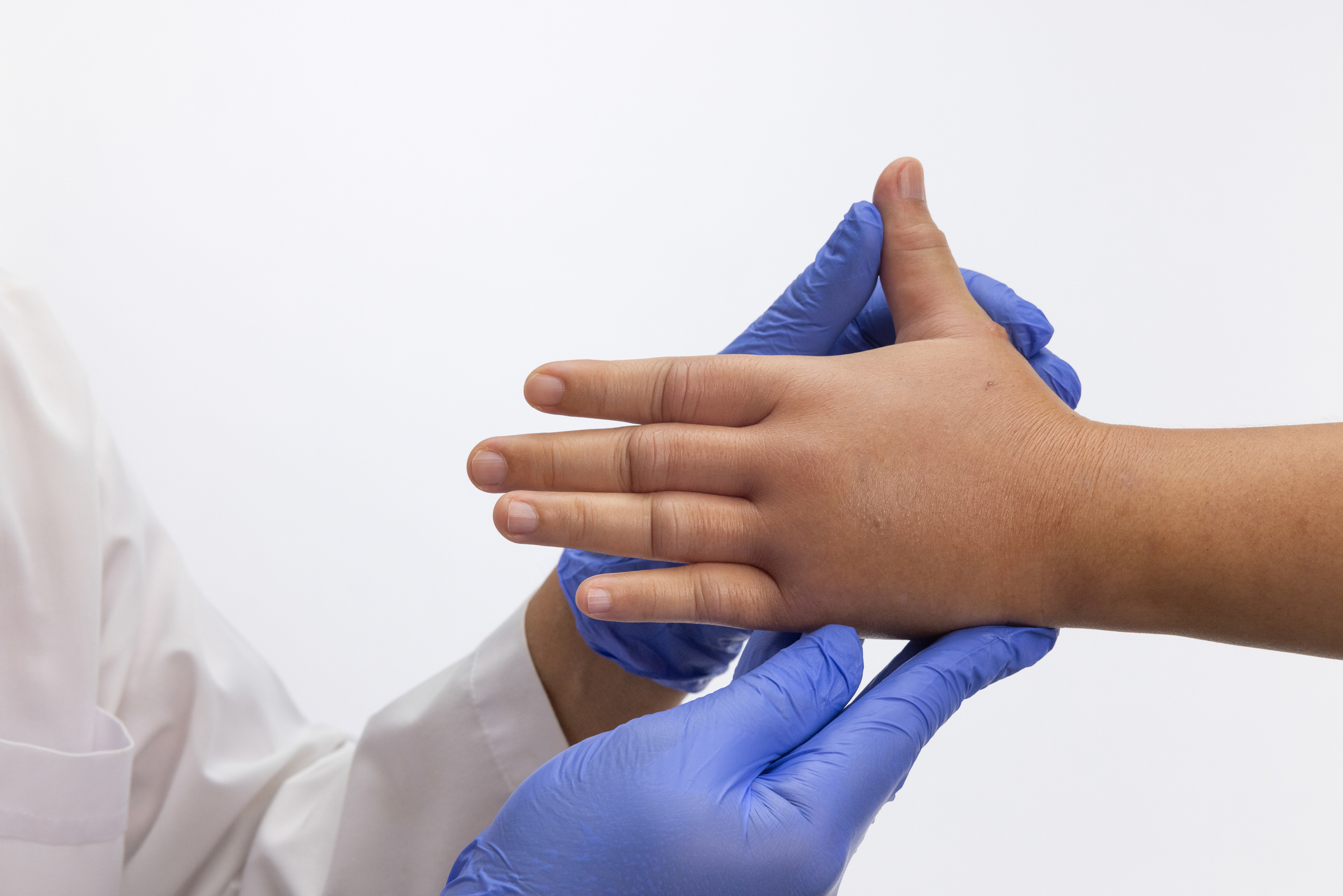 Un médico chequeando la picadura de una avispa en la mano a un niño.