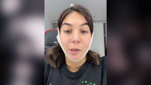 Operaciones estéticas