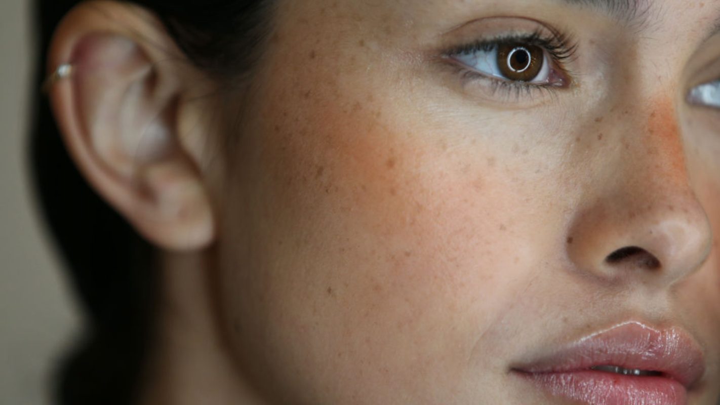 Cómo maquillar las falsas pecas.