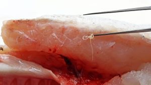 Detectan anisakis en una merluza
