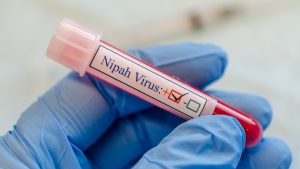 Virus Nipah