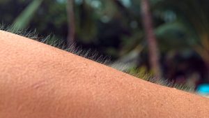 pelo erizado del brazo